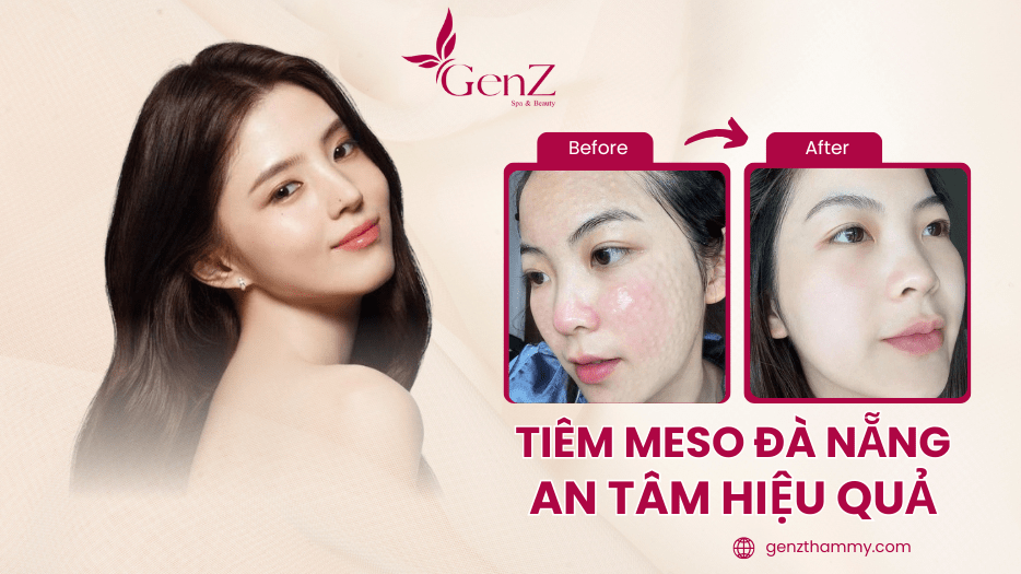 Tiêm Meso Đà Nẵng